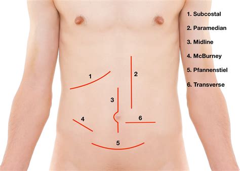 blood incision of the stomach